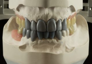 Dentist - Ashland Prosthodontist - Cosmetic Dentistry
